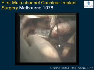 cochlear_implant_surgery
